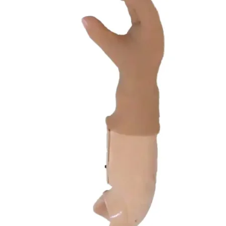 Custom-Made Below-Elbow Mechanical Arm Prosthesis