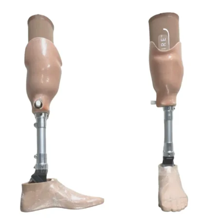 Above-Knee Prosthesis with Pin System and Silicone Liner