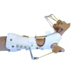 Radial-Palsy-Splint-001